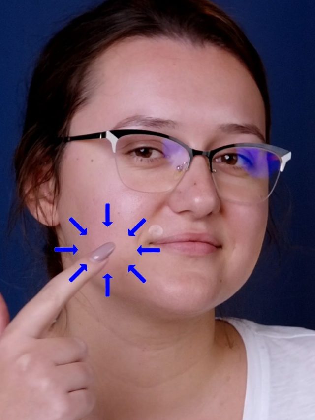 How to Treat Any Kind of Pimples – Full Guide