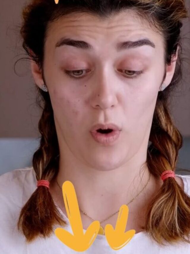 Innovative Pimple Patches – the ultimate comparison